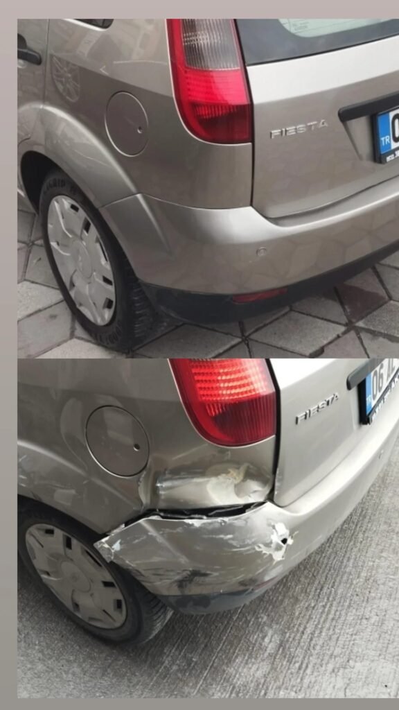 oncesi sonrasi5